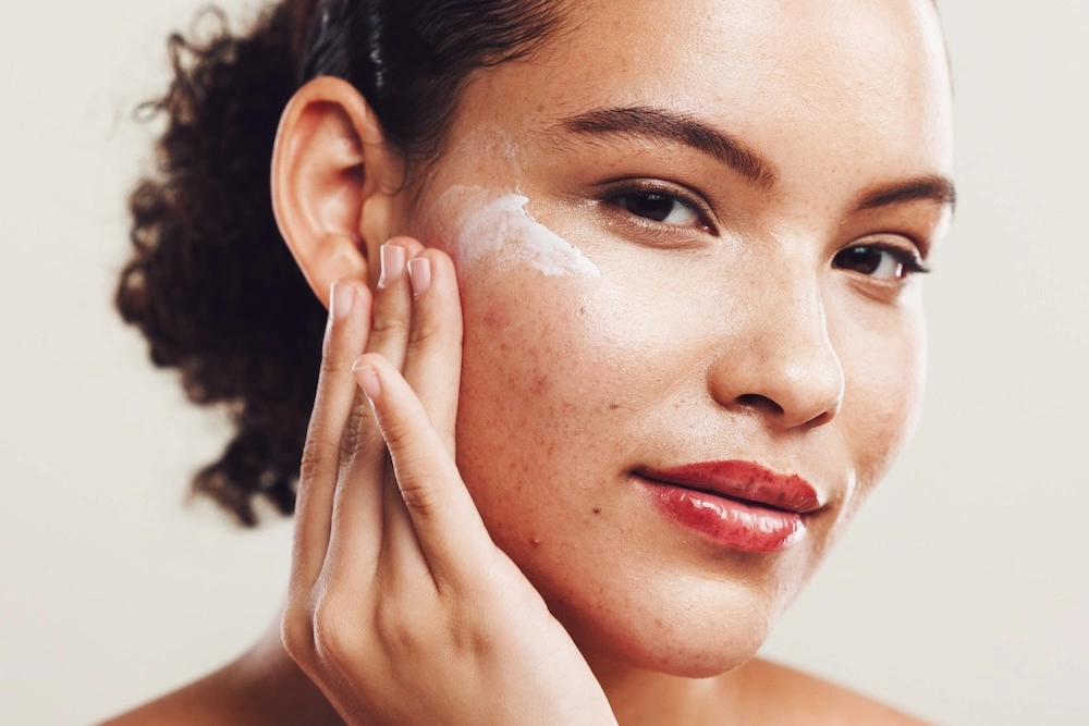 woman putting acne cream on face