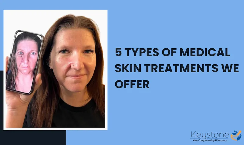featured image medical skin treatments